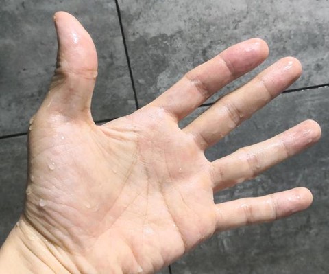 手出汗怎么玩王者荣耀[图2]